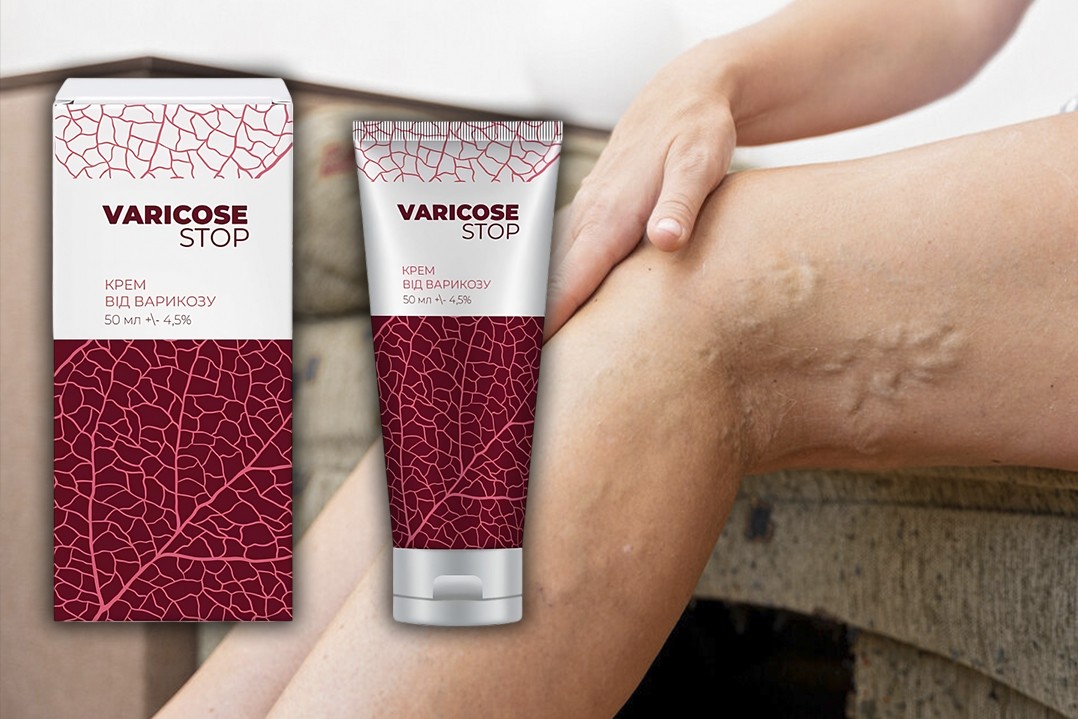 varicosestop