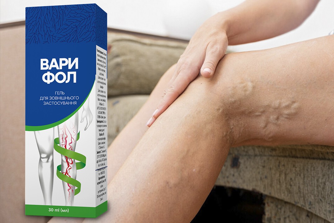 Огляд на крем від варикозу Варифол